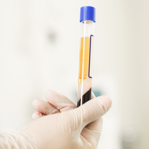 Canva Design DAGk80XOTTk