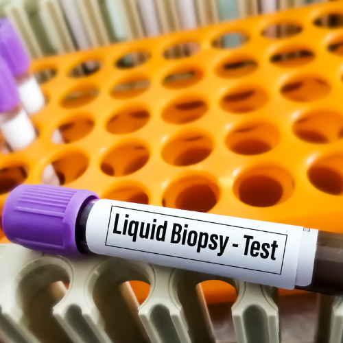 liquid biopsy tests